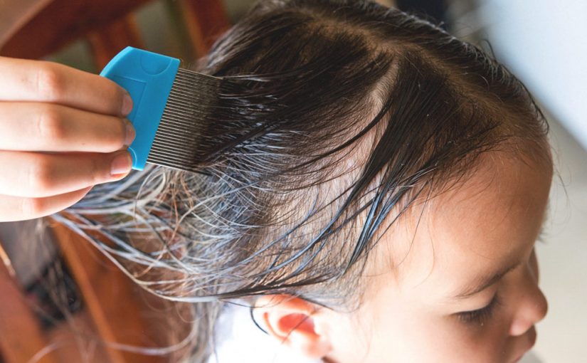 Think to Know About Head Lice Treatments