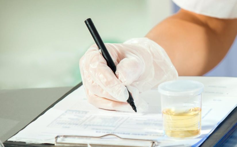 Urine drug test without urine: check out this guide